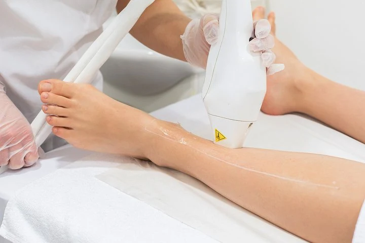Perfect Woman Ulm Dauerhafte Haarentfernung – Innenstadt, Ulm